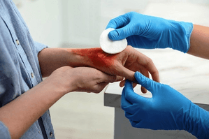 CSIR-IICT to promote surgical adhesive for rapid wound closure