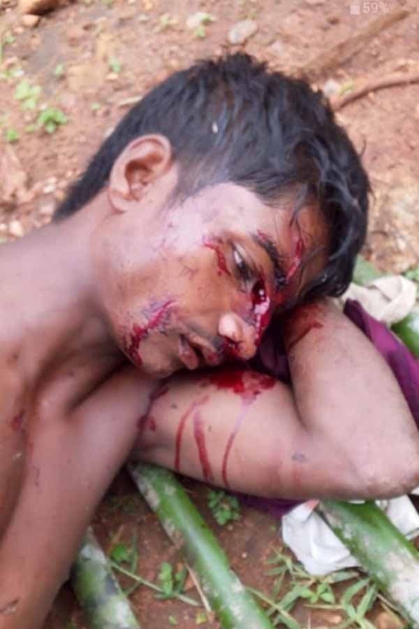Wild Bear Attacked Young Shepherd